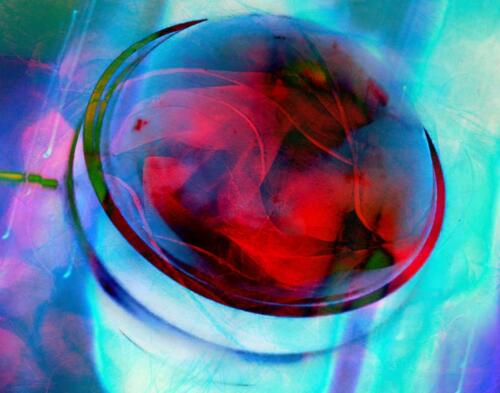 Abstract View1        